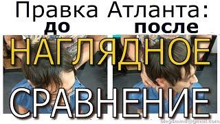 Результаты Правки Атланта - До и После. Наглядное сравнение! Правка в Волгодонске