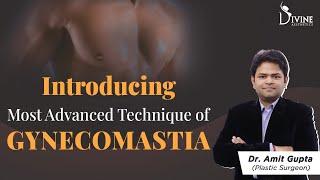 Introducing the  Most Advanced Technique of Gynecomastia | Dr. Amit Gupta