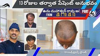 Hair Transplant In Hyderabad | Best Surgeon Center & Results Of Hair Transplant Surgery In Hyderabad