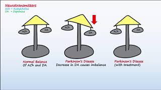 Parkinson's Disease