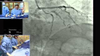 Part 1: Complex PCI Case - Patient Presentation and Access