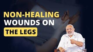 Understanding of Non-Healing Leg Wounds Made Simple: Part 1 | Surgery Simplified