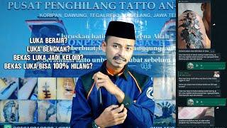 CARA MERAWAT LUKA BEKAS HAPUS TATTO (Q&A)