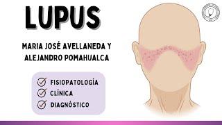 LUPUS ERITEMATOSO SISTÉMICO | Patología General