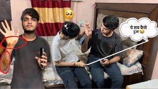 आकाश का accident  Ho gaya￼ || ये Sab Kaise Hua  || #vlog #its_crazy_parul1