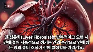 되돌릴 수 있었는데! 간섬유화(Liver Fibrosis)