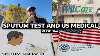   - XRAY and Sputum TEST for TB - Vaccine Record for US Immigration Medical  - 144.