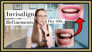 Invisalign Refinements Update (18 months later)  |  Cracked Tray, Stained Tooth, Gums & Bite