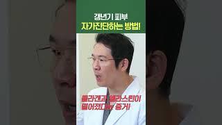 갱년기 피부 자가진단법 #shorts