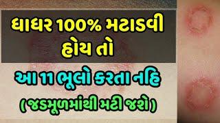 ધાધર 100% મટાડવી હોય તો આ 11 ભૂલો કરતા નહિ - જડમૂળમાંથી મટી જશે || Veidak vidyaa || 1 ||