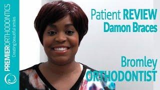 Damon Braces Review Premier Orthodontics Bromley : Review by Milika From Harrow