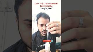 Day 19/180. Traya Minoxidil Journey #traya #trayaminoxidil #minoxidilresult