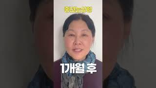 중년눈성형 8개월 변화 과정 #상안검