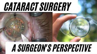 Cataract Surgery Simplified - A Surgeon's Perspective