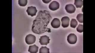 Макрофаг ловит бактерию macrophage catches bacterium)