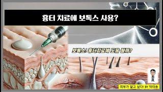 보톡스가 흉터치료에 도움을 주는 이유