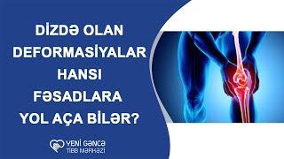 DİZDƏ OLAN DEFORMASİYALAR SONRADAN HANSI FƏSADLARA YOL AÇA BİLƏR