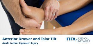 Anterior Drawer and Talar Tilt | Ankle Lateral Ligament Injury