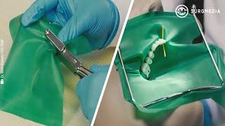 Basics of Dental (Rubber) Dam Placement