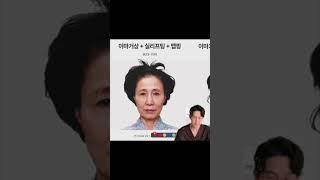 Ep5-1. 리프팅공부하기 대구이마거상 / 이마거상 상담 전 미리 알고가면 좋은 것 3가지 #이마거상술 #대구이마거상 #대구성형외과 #대구리프팅 
