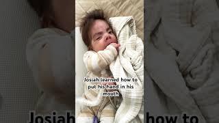 Josiah learned how to put his hand in his mouth #trachbaby #gtube