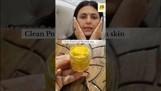 Homemade Cream for glowing skin at home by Dr Upasna vohra #glowingskin#openporesremedy#skincaretips