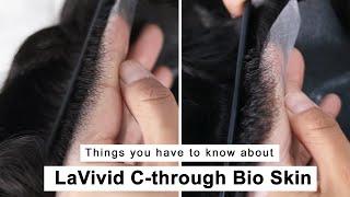 Innovative C-Through Bio Skin - Hair Replacement System - LaVivid Hair