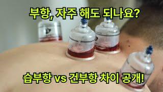 부항, 자주 해도 될까? 한의사가 알려주는 부항치료의 모든 것 #부항 #cupping #cuppingtherapy