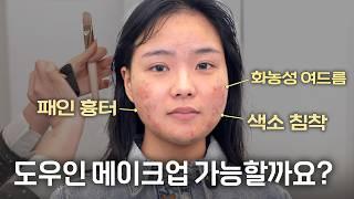 화농성 여드름 피부지만 화려한 메이크업해보고 싶어요.. 가능할까요?