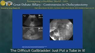 The Difficult Gallbladder: Just Put a Tube in It!