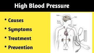 High BP ( Hypertension ) Causes , Symptoms and Treatment.