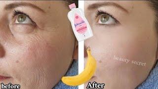 Baby oil and banana are more powerful than Botox, they fill in fine lines and wrinkles.￼