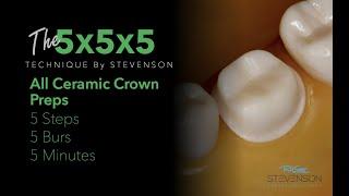 All Ceramic Crown Prep in 5 Minutes| The 5x5x5 Technique