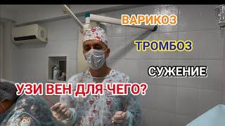 УЗИ ВЕН ДЛЯ ЧЕГО? Диагностика Варикоза, Тромбоза, сужений, патологии отхождения. Флеболог Москва