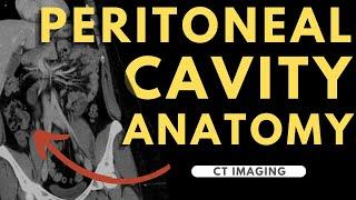 Peritoneal cavity, abdominal organs and spaces | Radiology anatomy part 1 prep | CT abdomen