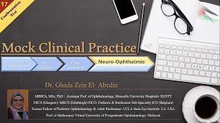 17# Mock Clinical Practice [Neuro- Ophth: Confrontation Visual Field Test]