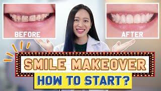 Veneers? Crowns? Smile Makeover MUST-KNOWS | #SmileMakeover !