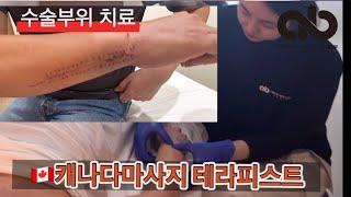 제 2탄! 수술 한달 후 마사지 통증완화 비포 에프터 [Post surgery massage treatment Canada Vancouver RMT- before after tx]