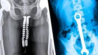 20 Strangest Things Discovered by X-Rays