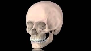 IMDO jaw surgery explained