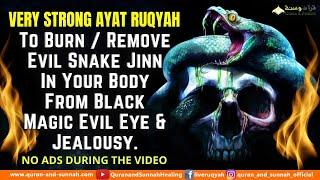 AL QURAN RUQYAH TO BURN / REMOVE EVIL SNAKE JINN, BLACK MAGIC EVIL EYE & JEALOUSY IN YOUR BODY HOME.