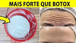 MAIS FORTE QUE BOTOX, Creme Caseiro Para RUGAS e MANCHAS Escuras na Pele