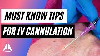 Important tips and tricks for IV cannulation!