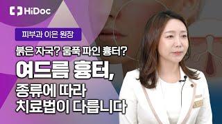 붉은 자국? 파인 흉터? 여드름 흉터, 종류에 따라 치료법이 다릅니다!...피부과 이은 원장