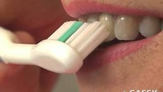 Oral Conditions Brush Abrasion