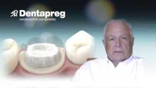 Dentapreg: Tips by Dr. Pitz 01: Composite Restorations
