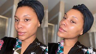 MY SKINCARE ROUTINE | HOW I CLEARED MY ACNE PRONE SKIN | BEFORE & AFTER PICTURES!!