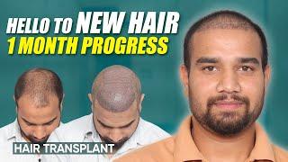 Hair Transplant in Vasai | Best Results & Cost of Hair Transplant in Vasai