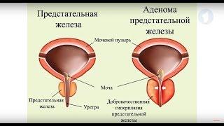 Роль простаты в организме мужчины / Здравствуйте