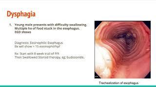 ABIM Internal Medicine Board Prep Series. Gastroenterology and Hepatology Part 1